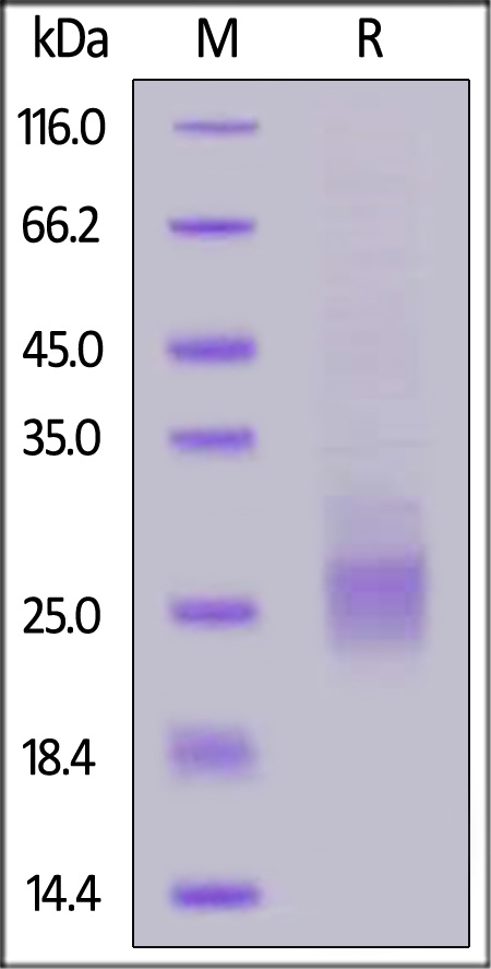 Human CD37, His Tag (Cat. No. CD7-H52H3) SDS-PAGE gel