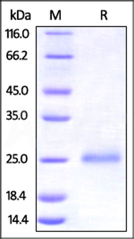 Human CD99, His Tag (Cat. No. CD9-H5221) SDS-PAGE gel