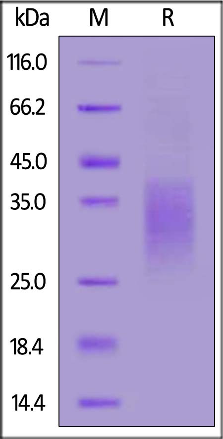 Human CD79A, His Tag (Cat. No. CDA-H52H8) SDS-PAGE gel