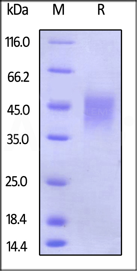 Human CD16b (NA2), His Tag (Cat. No. CDB-H5222) SDS-PAGE gel