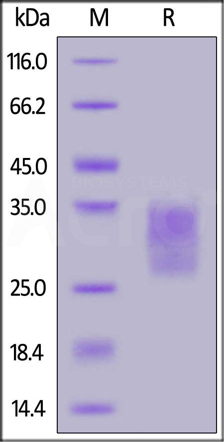 Mouse CD79B, His Tag (Cat. No. CDB-M52H3) SDS-PAGE gel