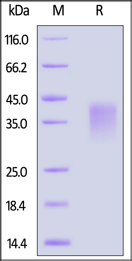 Human CD300c, His Tag (Cat. No. CDC-H5224) SDS-PAGE gel