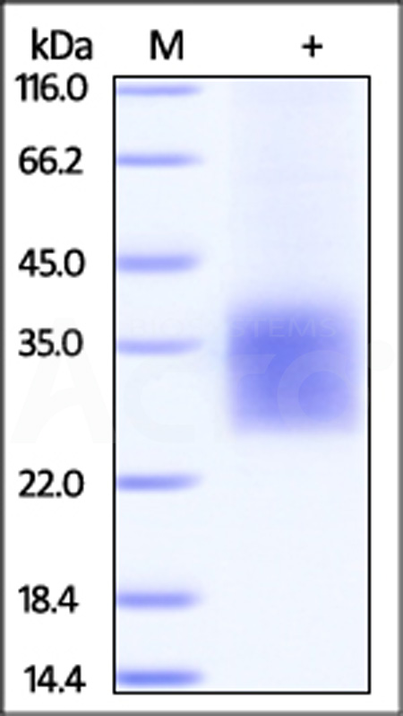 Cynomolgus CD3 delta, His Tag (Cat. No. CDD-C52H8) SDS-PAGE gel