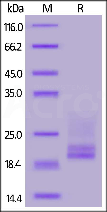 Human CD3E&CD3D Heterodimer Protein, His Tag&Tag Free (Cat. No. CDD-H52W1) SDS-PAGE gel