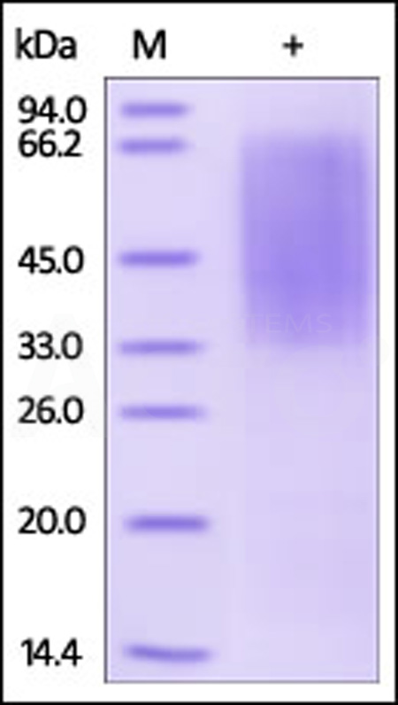 Human CD300LG, His Tag (Cat. No. CDG-H5223) SDS-PAGE gel