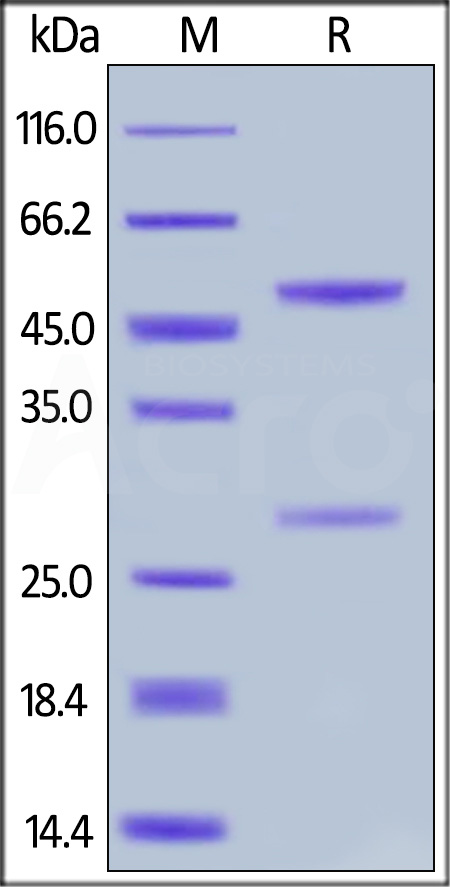 Anti-Cetuximab Antibodies (recommended for ADA assay) (Cat. No. CEB-Y27) SDS-PAGE gel