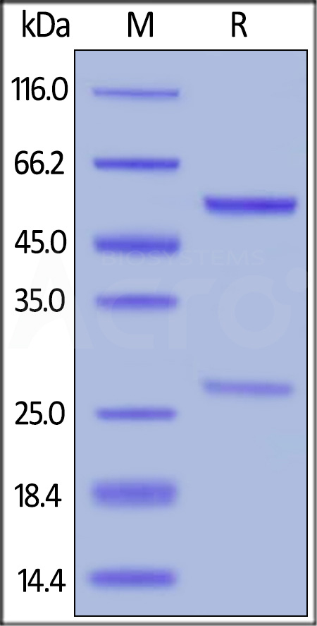Anti-Cetuximab Antibodies (Non-Neutralizing) (Cat. No. CEB-Y31) SDS-PAGE gel