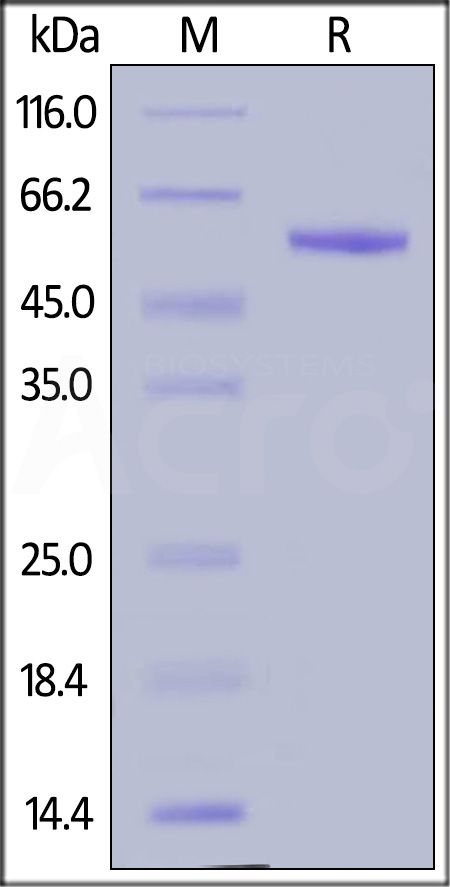 Human Complement Factor D, Fc Tag (Cat. No. CFD-H5256) SDS-PAGE gel