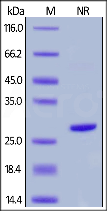 Human Complement Factor D, His Tag (Cat. No. CFD-H52H8) SDS-PAGE gel
