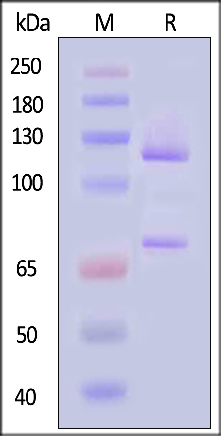 Human Complement C5 (w917s), His Tag (Cat. No. CO5-H52H7) SDS-PAGE gel
