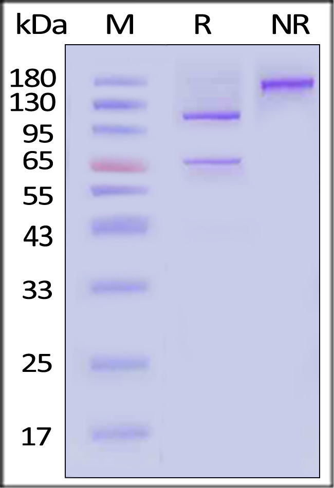 Human Complement C5, His Tag (Cat. No. CO5-H52Ha) SDS-PAGE gel