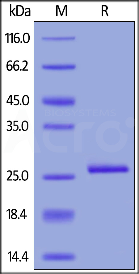 Human C-Reactive Protein, His Tag (Cat. No. CRP-H5226) SDS-PAGE gel