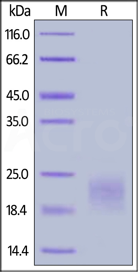 Cynomolgus / Rhesus macaque CTLA-4, His Tag (Cat. No. CT4-C5227) SDS-PAGE gel