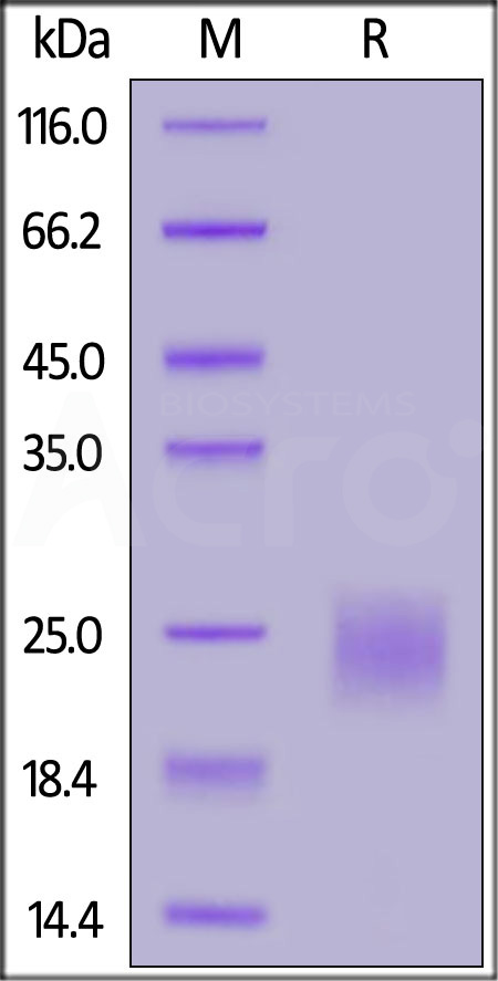 Human CTLA-4, His Tag (Cat. No. CT4-H5229) SDS-PAGE gel