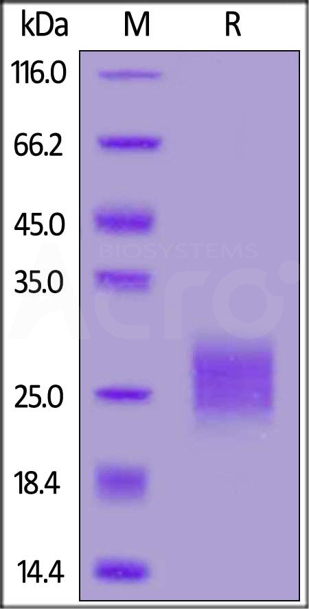Human CTLA-4, His Tag (Cat. No. CT4-H52H9) SDS-PAGE gel