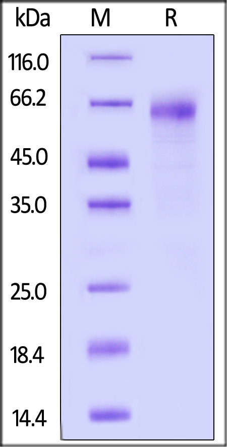 Human CXCL16, Fc Tag (Cat. No. CX6-H5254) SDS-PAGE gel