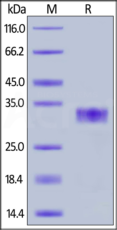 Human CXADR, His Tag (Cat. No. CXR-H5222) SDS-PAGE gel