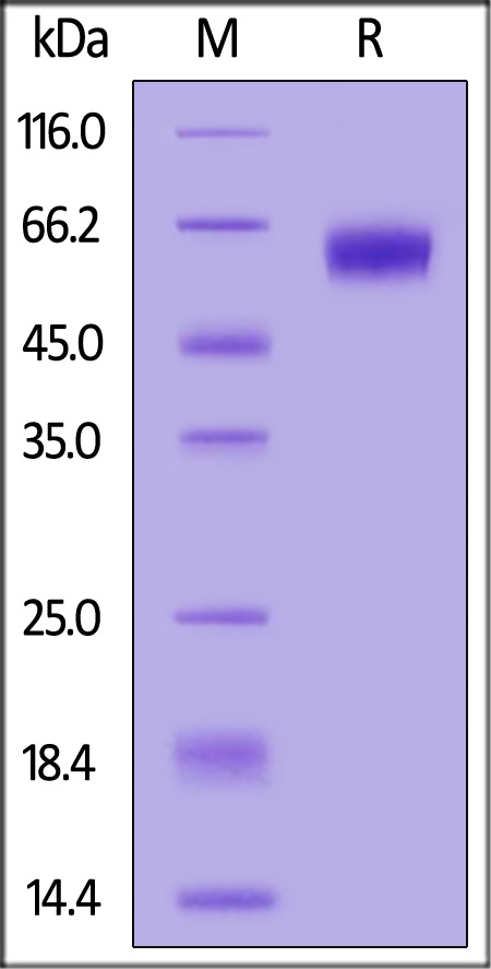 Biotinylated Human DDR1, His,Avitag (Cat. No. DD1-H82E9) SDS-PAGE gel