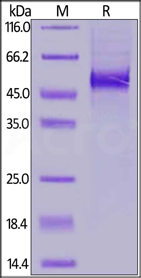 Human DLL3, His Tag (Cat. No. DL3-H52H4) SDS-PAGE gel