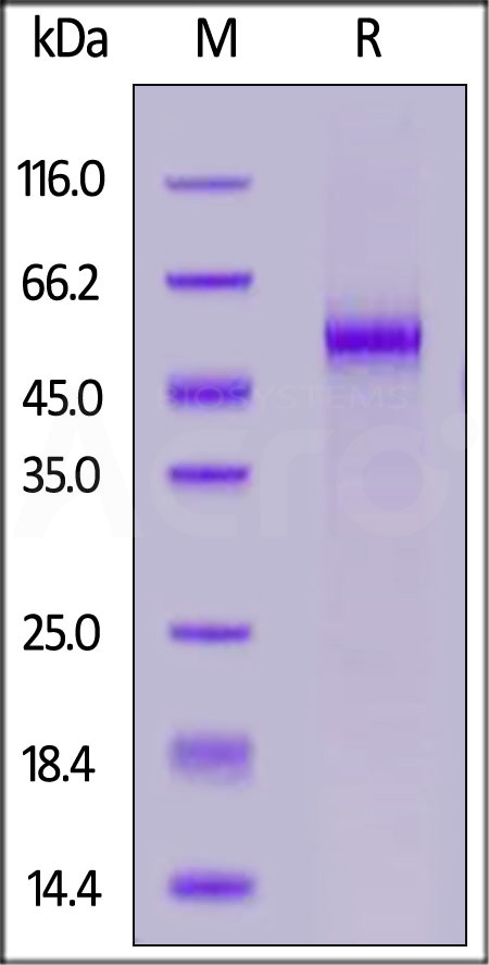 FITC-Labeled Human DLL3, His Tag (Cat. No. DL3-HF2H4) SDS-PAGE gel