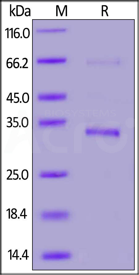 Envelope protein SDS-PAGE