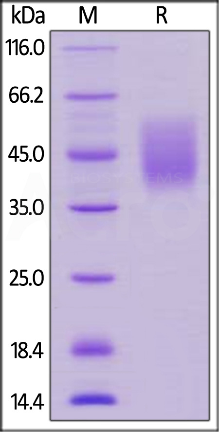 Human Fc epsilon RI alpha, His Tag (Cat. No. FCA-H5228) SDS-PAGE gel