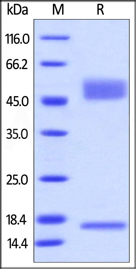 Biotinylated Mouse FcRn Heterodimer Protein, Avitag,His Tag&Twin-Strep Tag (Cat. No. FCM-M82W6) SDS-PAGE gel