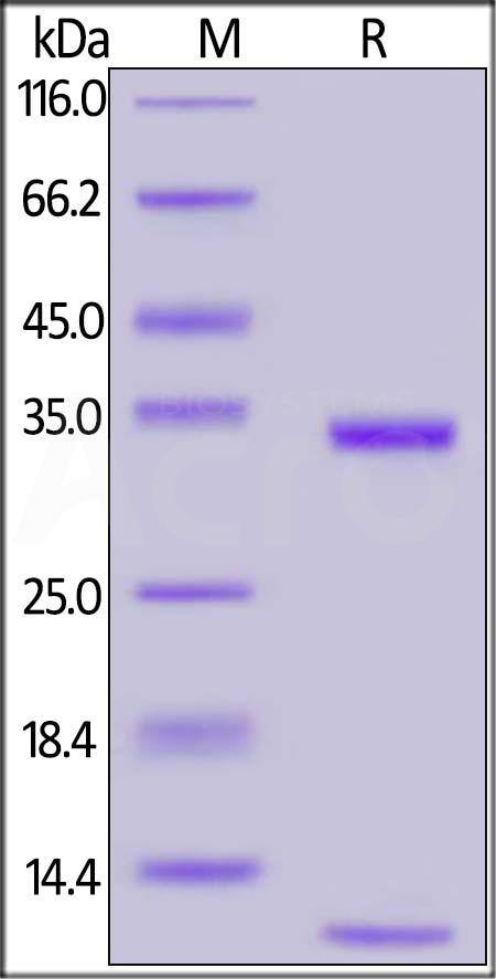 Rabbit FCGRT&B2M Heterodimer Protein, His Tag&Tag Free (Cat. No. FCM-R52W5) SDS-PAGE gel
