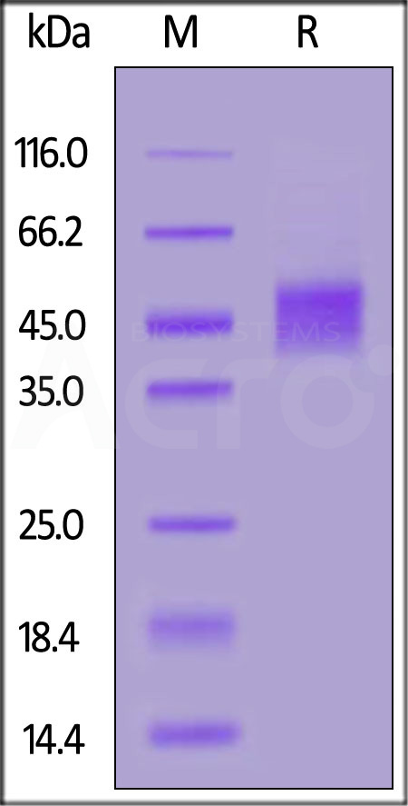 Human Follistatin-like 1, His Tag (Cat. No. FS1-H5227) SDS-PAGE gel