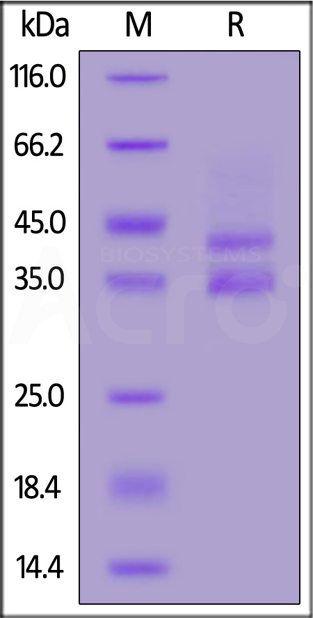 Human Gastrin-71 Protein, Fc tag (Cat. No. GAN-H5253) SDS-PAGE gel