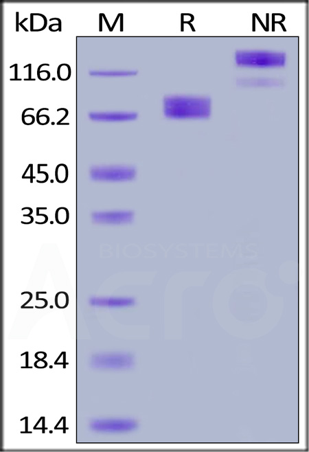 Human GHR, Fc Tag (Cat. No. GHR-H5257) SDS-PAGE gel
