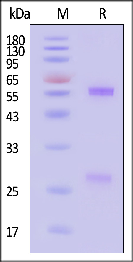 Glycoprotein D (HSV-2) SDS-PAGE
