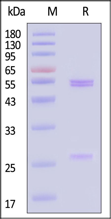 Glycoprotein D (HSV-2) SDS-PAGE