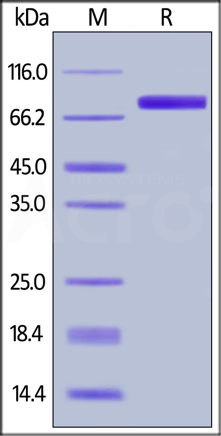 Human GM-CSF R alpha, Fc Tag (Cat. No. GRA-H5255) SDS-PAGE gel