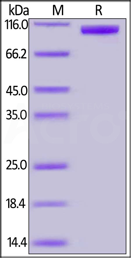 Influenza A [A/Shanghai/2/2013(H7N9)] HA, Fc Tag (Cat. No. HA9-V5253) SDS-PAGE gel