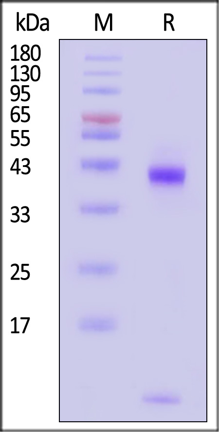 HLA-A*0201 | B2M | p53 (GLAPPQHLIRV) SDS-PAGE