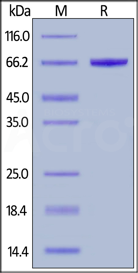 Human Serum Albumin, His Tag (Cat. No. HSA-H5220) SDS-PAGE gel
