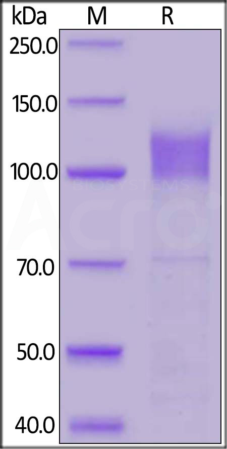 Human IFNAR1, Fc Tag (Cat. No. IF1-H5253) SDS-PAGE gel