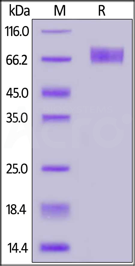 Human IFNAR2, Fc Tag (Cat. No. IF2-H5255) SDS-PAGE gel