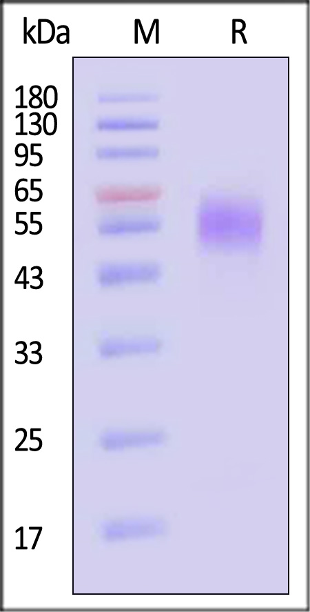 Human IL-13 R alpha 1 Protein, His Tag (Cat. No. IL1-H5224) SDS-PAGE gel
