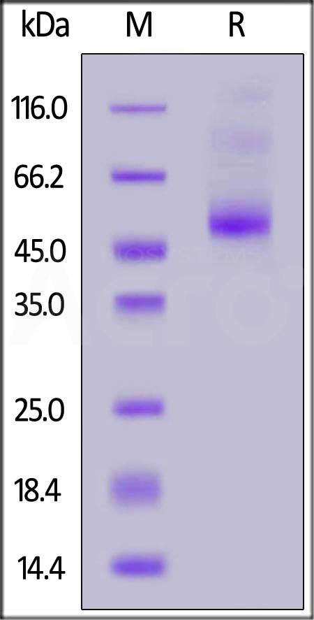 Biotinylated Human IL-13 R alpha 2, His,Avitag (Cat. No. IL2-H82E6) SDS-PAGE gel