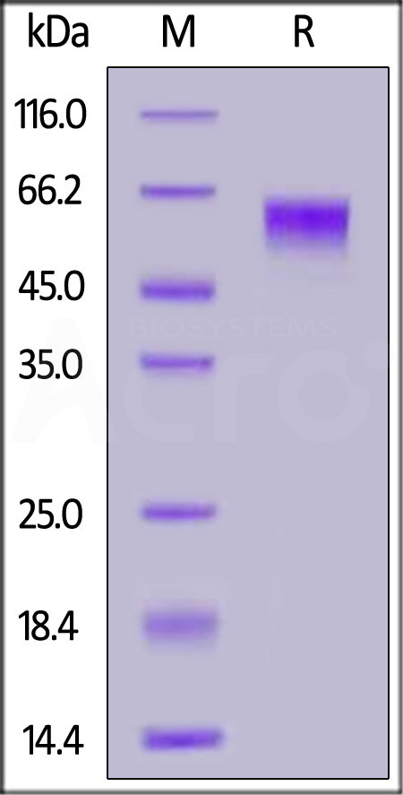Human IL-3 R alpha, His Tag (Cat. No. ILA-H52H6) SDS-PAGE gel