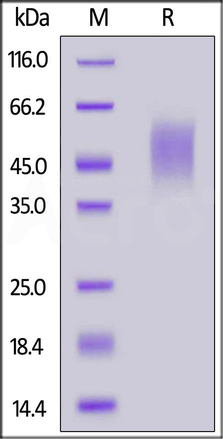 Mouse IL-2 R gamma, His Tag (Cat. No. ILA-M52H3) SDS-PAGE gel