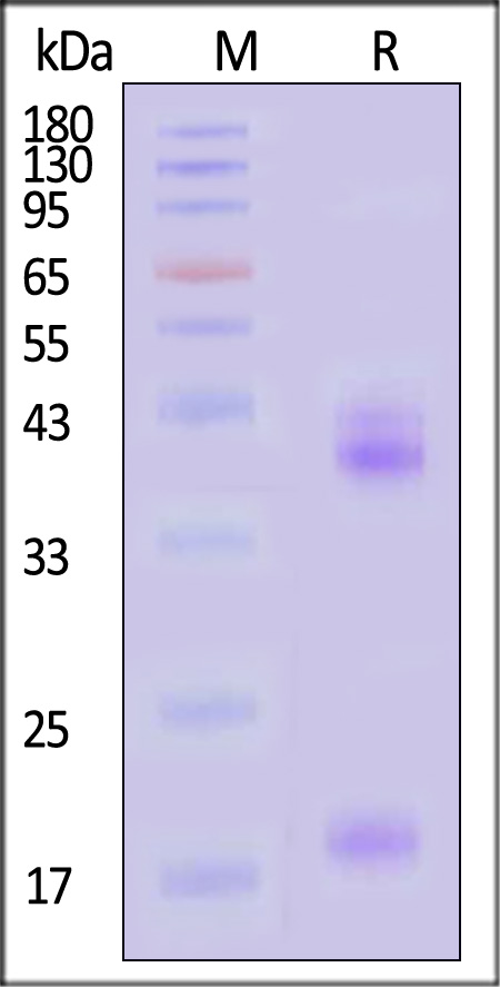 Human IL-23A&IL-12B Heterodimer Protein, His Tag&Tag Free (Cat. No. ILB-H52W5) SDS-PAGE gel
