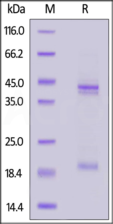 Mouse IL-23A&IL-12B Heterodimer Protein, His Tag&Tag Free (Cat. No. ILB-M52W7) SDS-PAGE gel