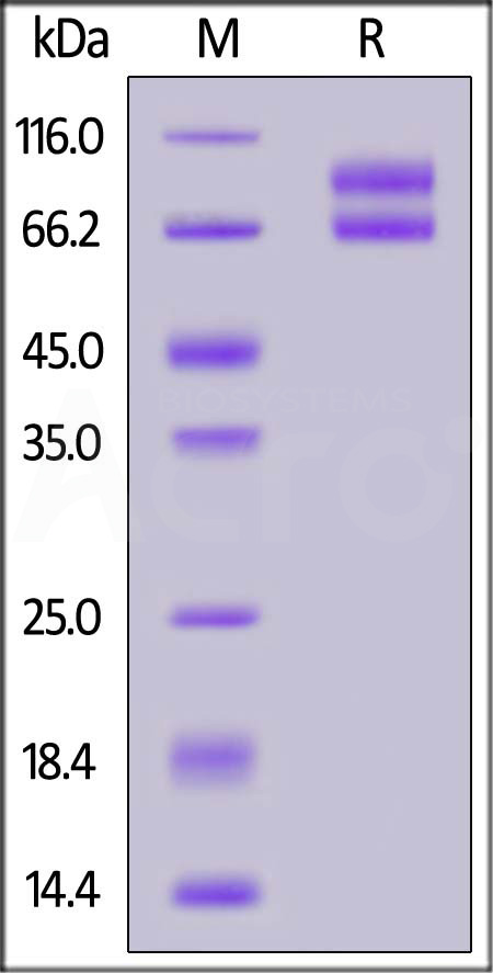 Biotinylated Cynomolgus IL-2RB&IL-2RG, Fc,Avitag&Fc,Avitag (Cat. No. ILG-C82F4) SDS-PAGE gel