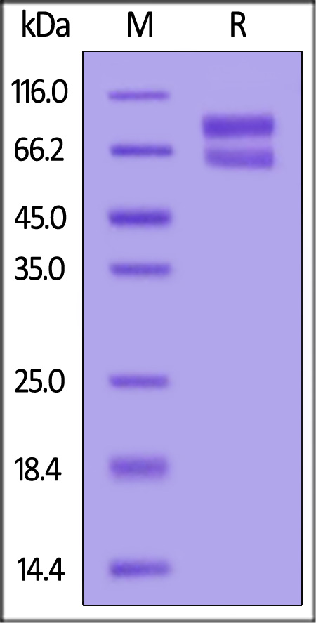 Human IL-2RB&IL-2RG Heterodimer Protein, Fc Tag&Fc Tag (MALS verified) (Cat. No. ILG-H5254) SDS-PAGE gel