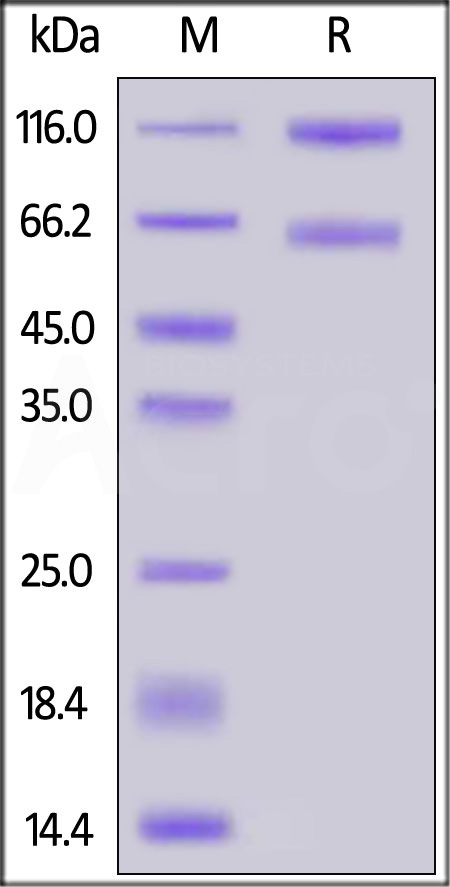 Human IL-2RB&IL-2RA&IL-2RG, Fc Tag&Fc Tag (Cat. No. ILG-H5257) SDS-PAGE gel