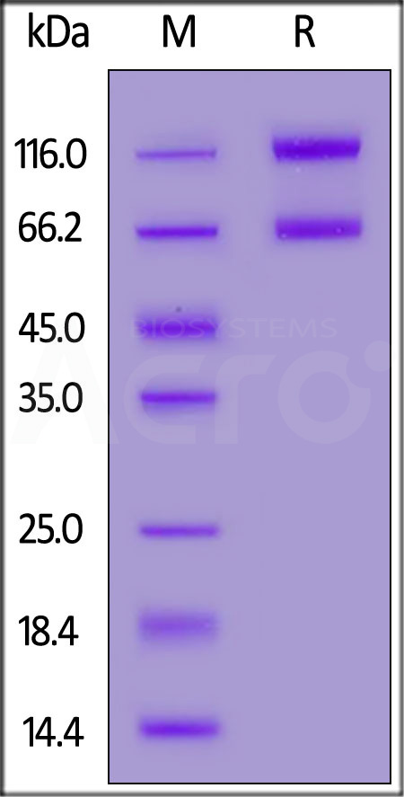 Biotinylated Human IL-2RB&IL-2RA&IL-2RG, Fc,Avitag&Fc,Avitag (Cat. No. ILG-H82F4) SDS-PAGE gel