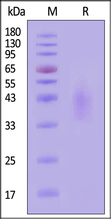 Human IL-4 R alpha, His Tag (Cat. No. ILR-H5221) SDS-PAGE gel